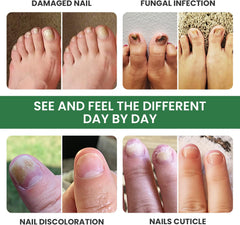 FOOT CURE Extra Strong Organic & USA Made Finger & Toenail Fungus Treatment